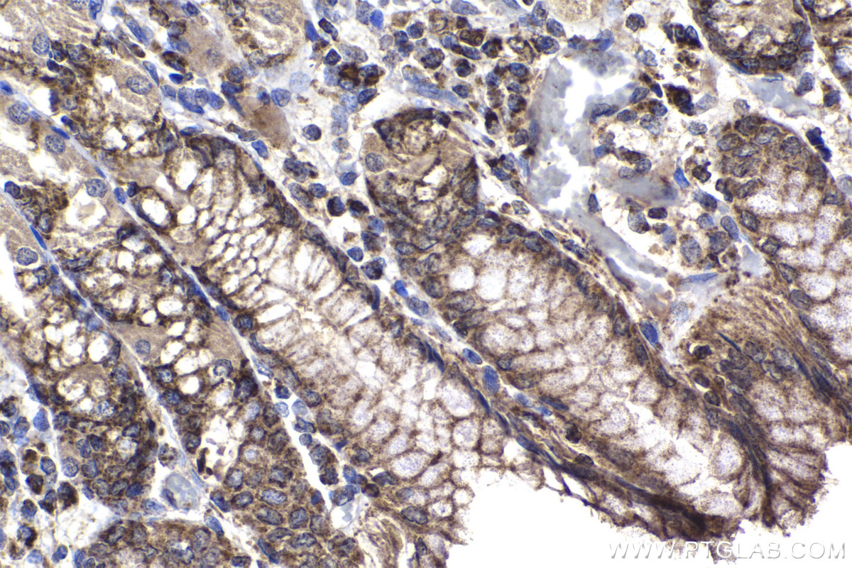 Immunohistochemical analysis of paraffin-embedded human stomach tissue slide using KHC2241 (SHMT2 IHC Kit).