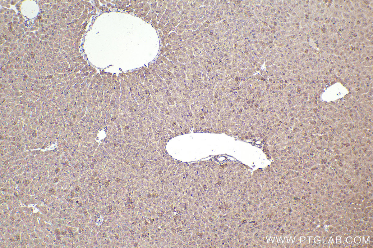 Immunohistochemical analysis of paraffin-embedded mouse liver tissue slide using KHC2241 (SHMT2 IHC Kit).