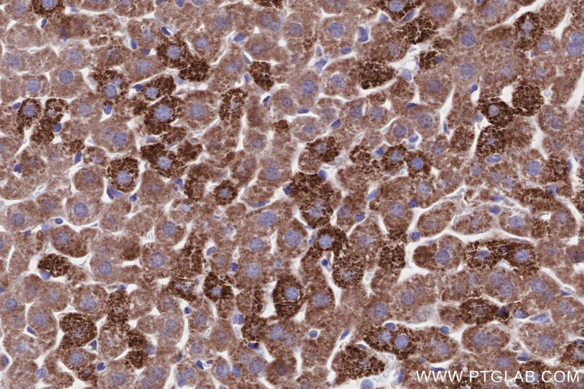 Immunohistochemical analysis of paraffin-embedded mouse liver tissue slide using KHC2643 (SIAH1 IHC Kit).