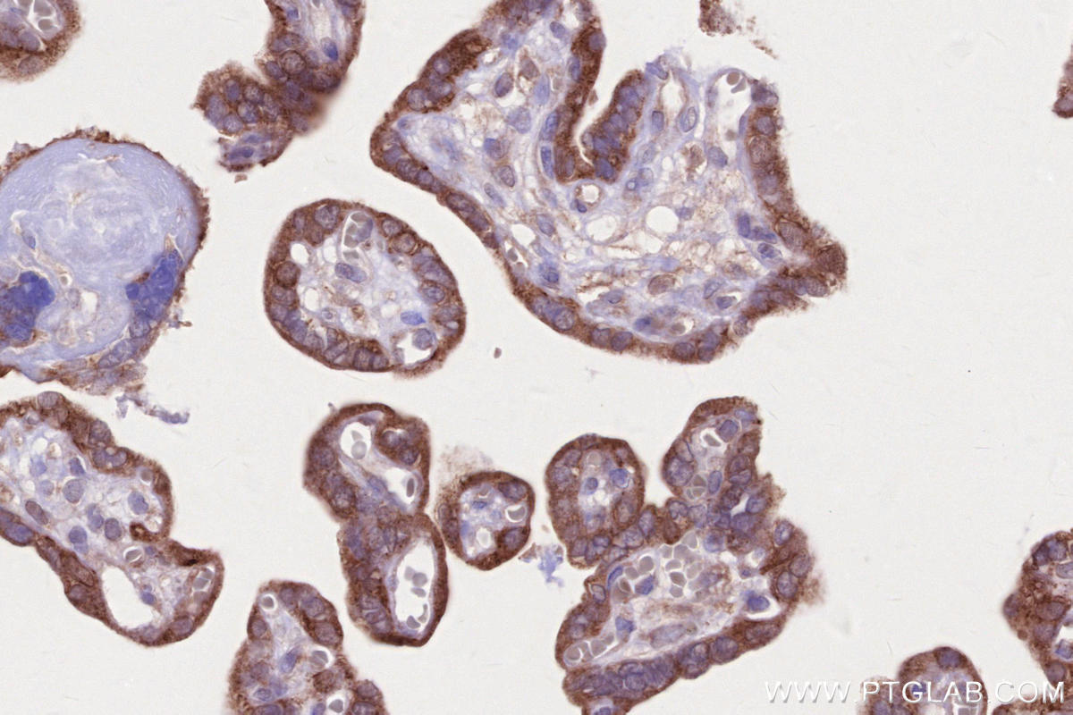 Immunohistochemical analysis of paraffin-embedded human placenta tissue slide using KHC2643 (SIAH1 IHC Kit).