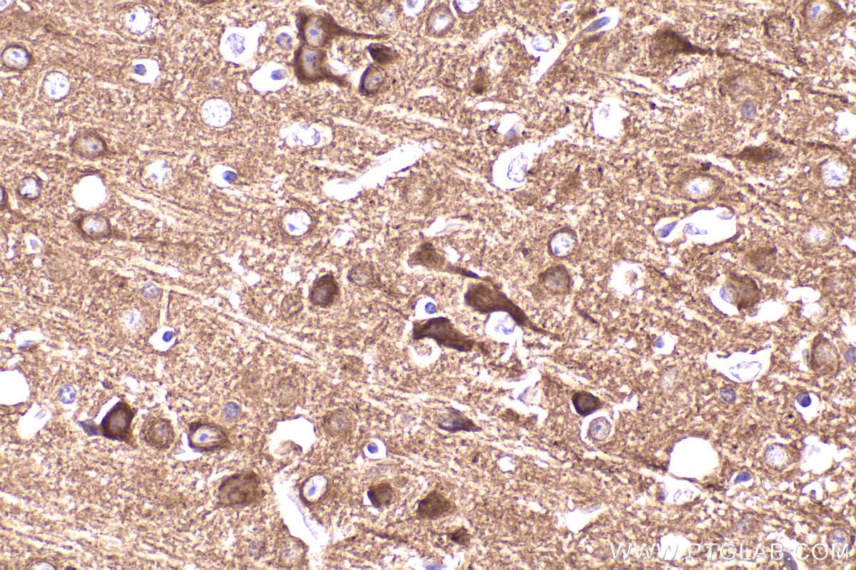 Immunohistochemical analysis of paraffin-embedded mouse brain tissue slide using KHC2490 (SKIV2L IHC Kit).