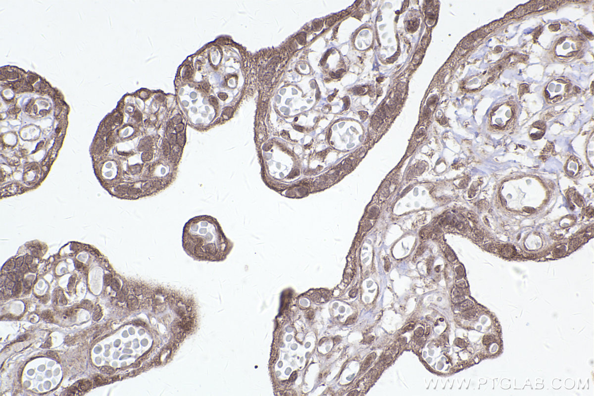 Immunohistochemical analysis of paraffin-embedded human placenta tissue slide using KHC2490 (SKIV2L IHC Kit).