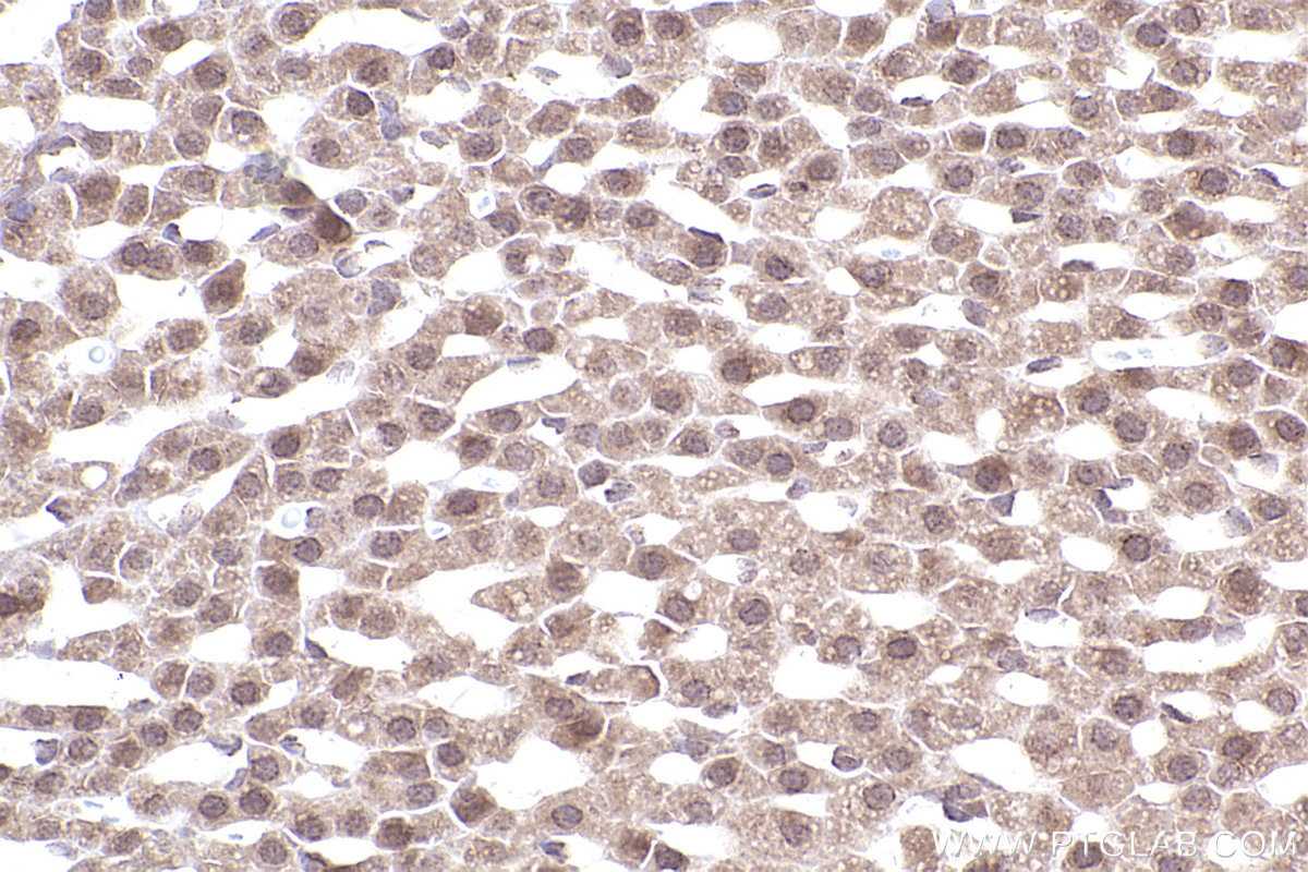 Immunohistochemical analysis of paraffin-embedded rat adrenal gland tissue slide using KHC2490 (SKIV2L IHC Kit).