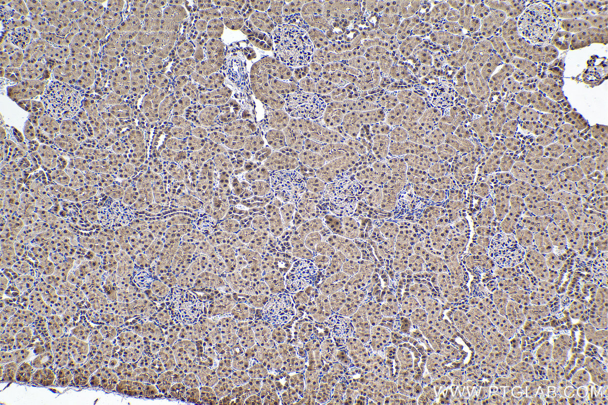 Immunohistochemical analysis of paraffin-embedded rat kidney tissue slide using KHC2360 (SKP1 IHC Kit).