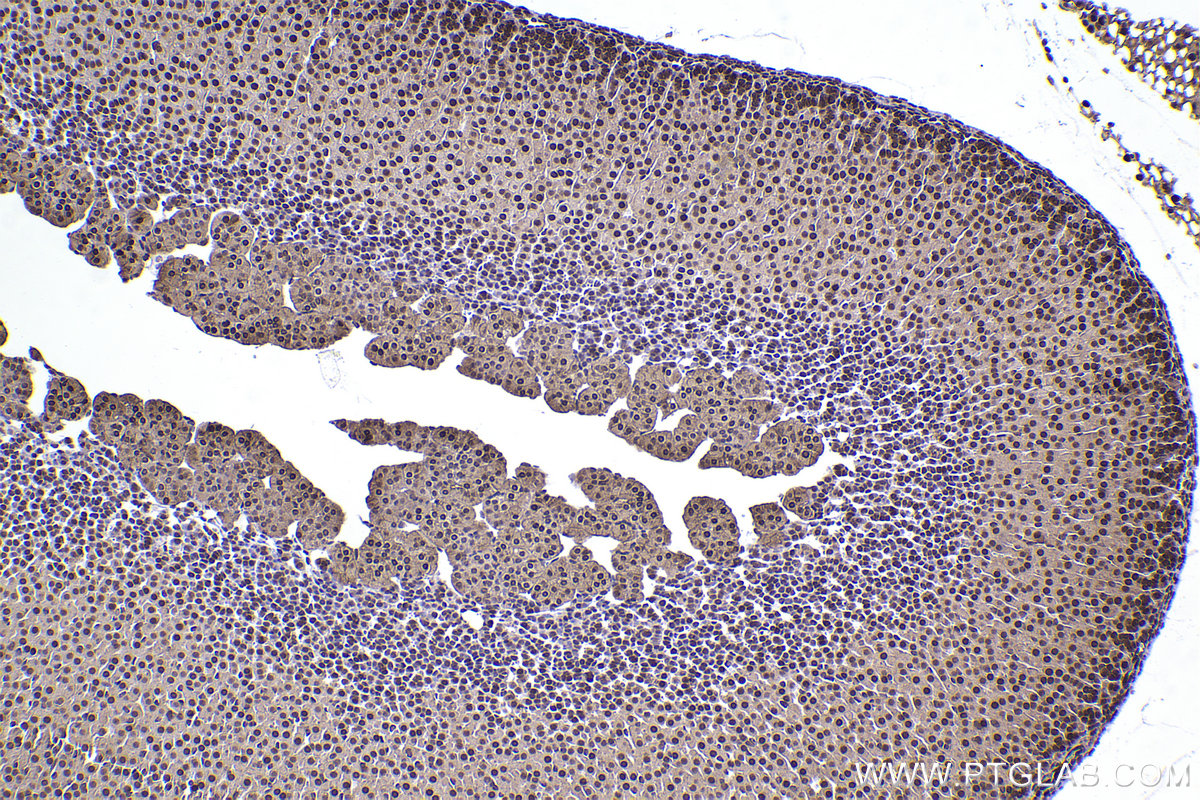 Immunohistochemical analysis of paraffin-embedded mouse adrenal gland tissue slide using KHC2360 (SKP1 IHC Kit).