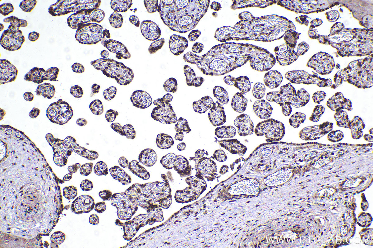 Immunohistochemical analysis of paraffin-embedded human placenta tissue slide using KHC2360 (SKP1 IHC Kit).