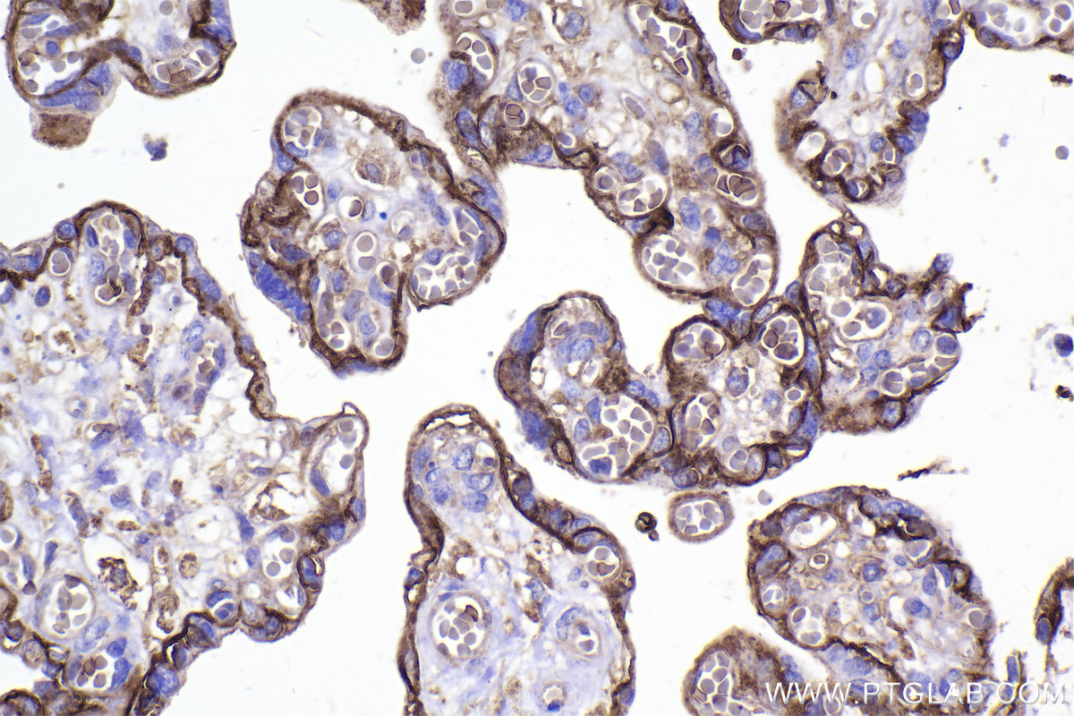 Immunohistochemical analysis of paraffin-embedded human placenta tissue slide using KHC2321 (SLC16A1/MCT1 IHC Kit).