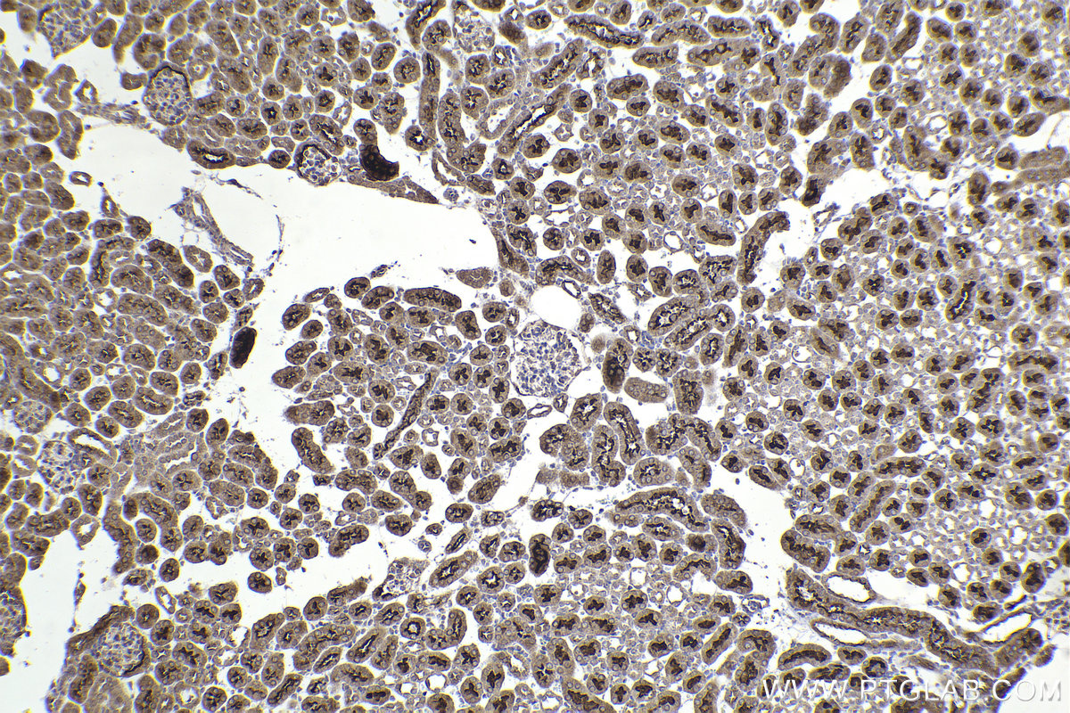 Immunohistochemical analysis of paraffin-embedded mouse kidney tissue slide using KHC2262 (SLC1A1/EAAT3 IHC Kit).