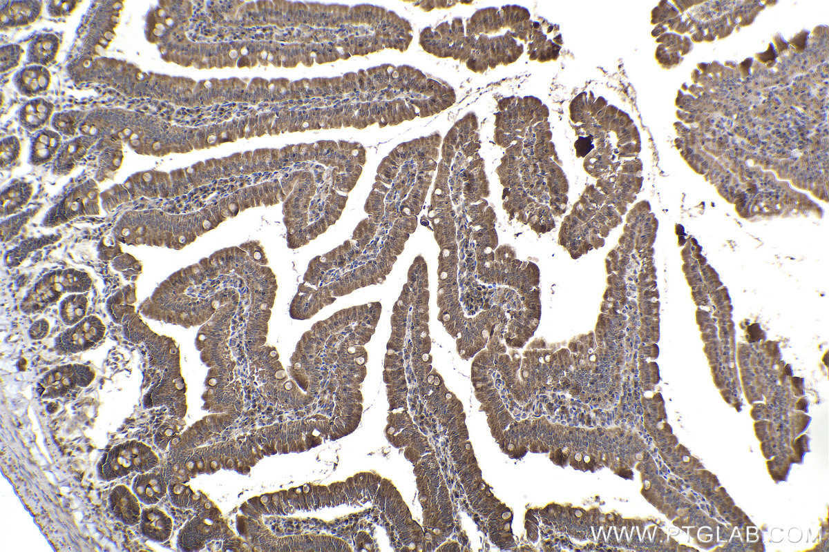 Immunohistochemical analysis of paraffin-embedded rat small intestine tissue slide using KHC2262 (SLC1A1/EAAT3 IHC Kit).