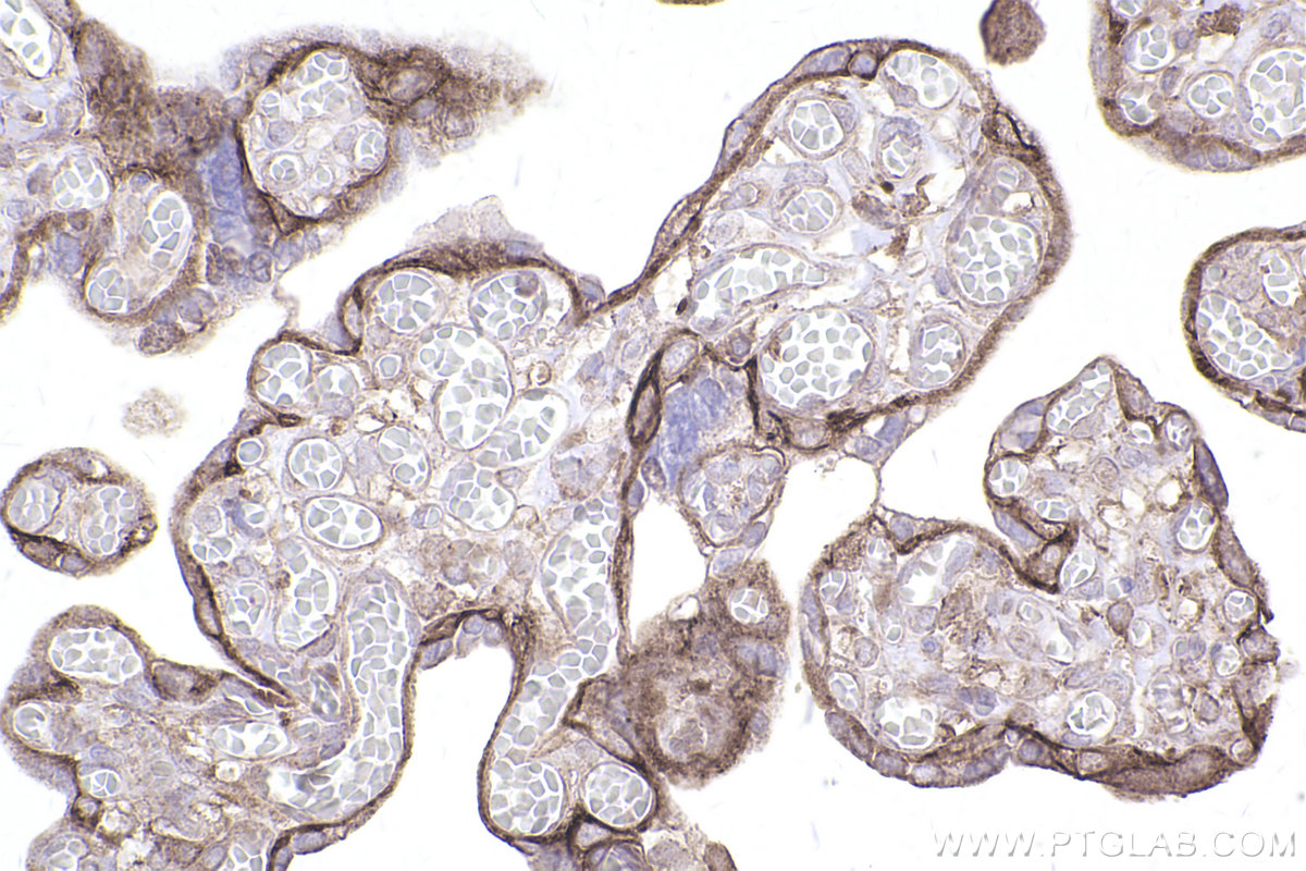 Immunohistochemical analysis of paraffin-embedded human placenta tissue slide using KHC2497 (SLC1A5/ASCT2 IHC Kit).