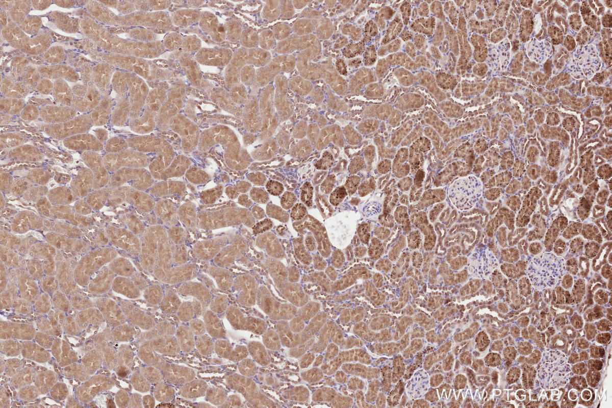 Immunohistochemical analysis of paraffin-embedded rat kidney tissue slide using KHC2583 (SLC30A6/ZNT6 IHC Kit).