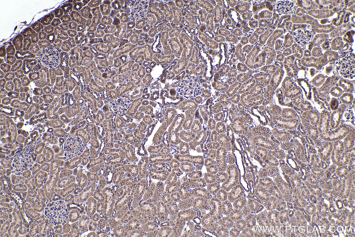 Immunohistochemical analysis of paraffin-embedded rat kidney tissue slide using KHC2384 (SLC7A5 IHC Kit).