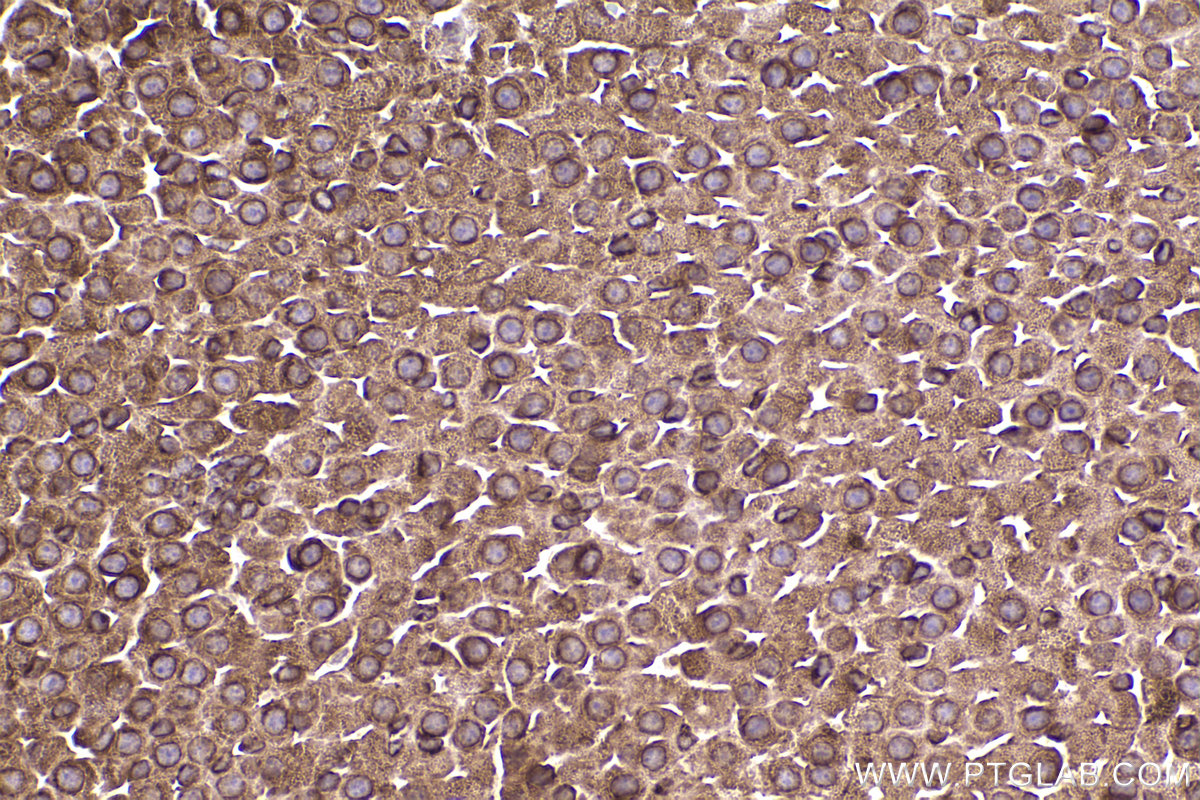 Immunohistochemical analysis of paraffin-embedded mouse adrenal gland tissue slide using KHC2384 (SLC7A5 IHC Kit).