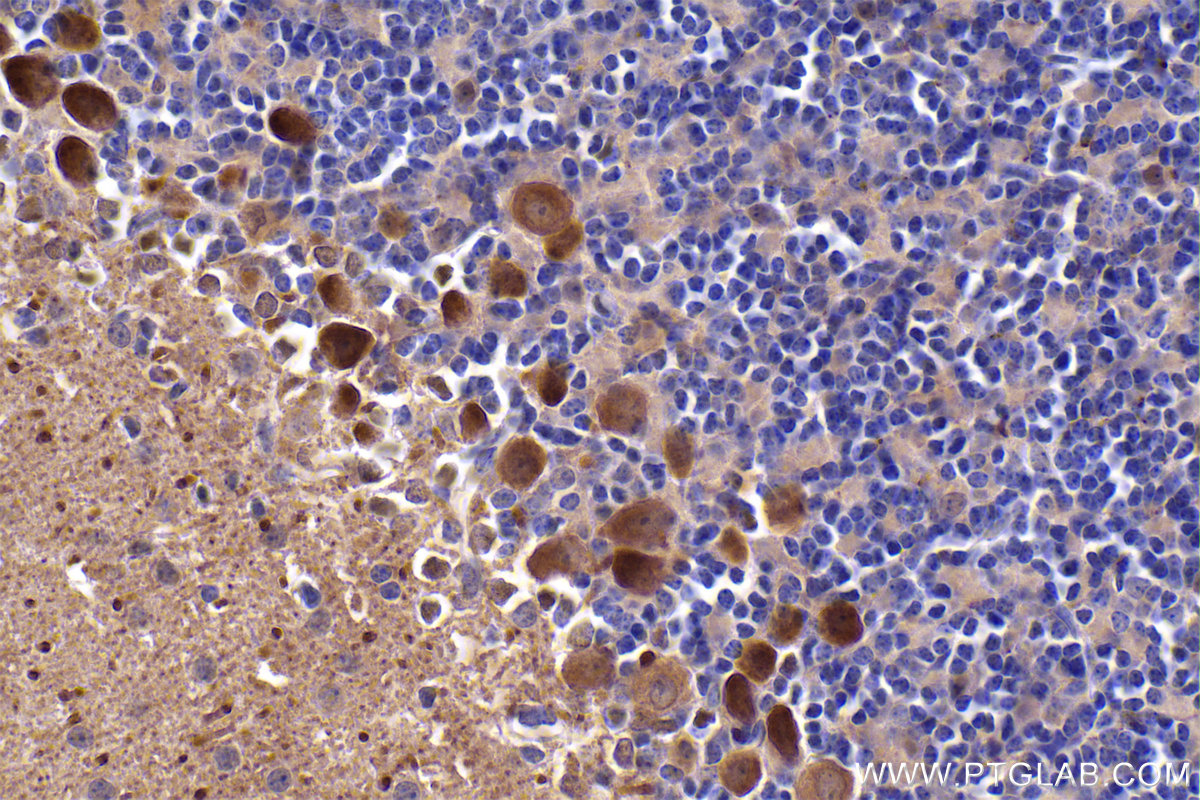 Immunohistochemical analysis of paraffin-embedded mouse cerebellum tissue slide using KHC2372 (SMAD3 IHC Kit).