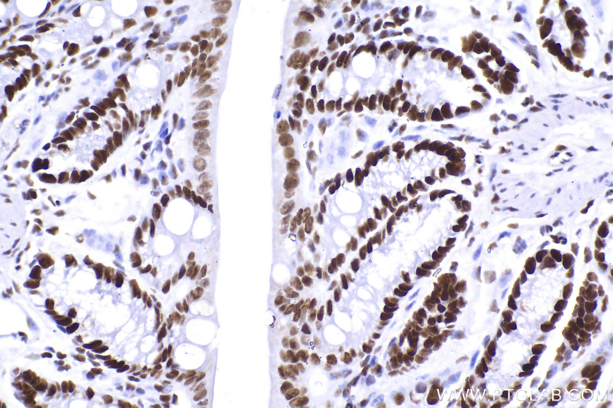 Immunohistochemical analysis of paraffin-embedded mouse colon tissue slide using KHC2303 (SMARCA4 IHC Kit).