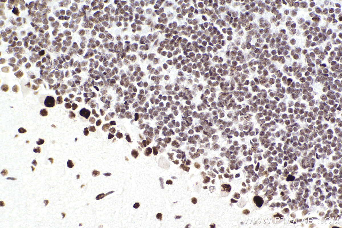 Immunohistochemical analysis of paraffin-embedded mouse cerebellum tissue slide using KHC2303 (SMARCA4 IHC Kit).