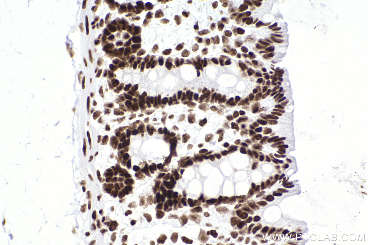 Immunohistochemical analysis of paraffin-embedded rat colon tissue slide using KHC2303 (SMARCA4 IHC Kit).