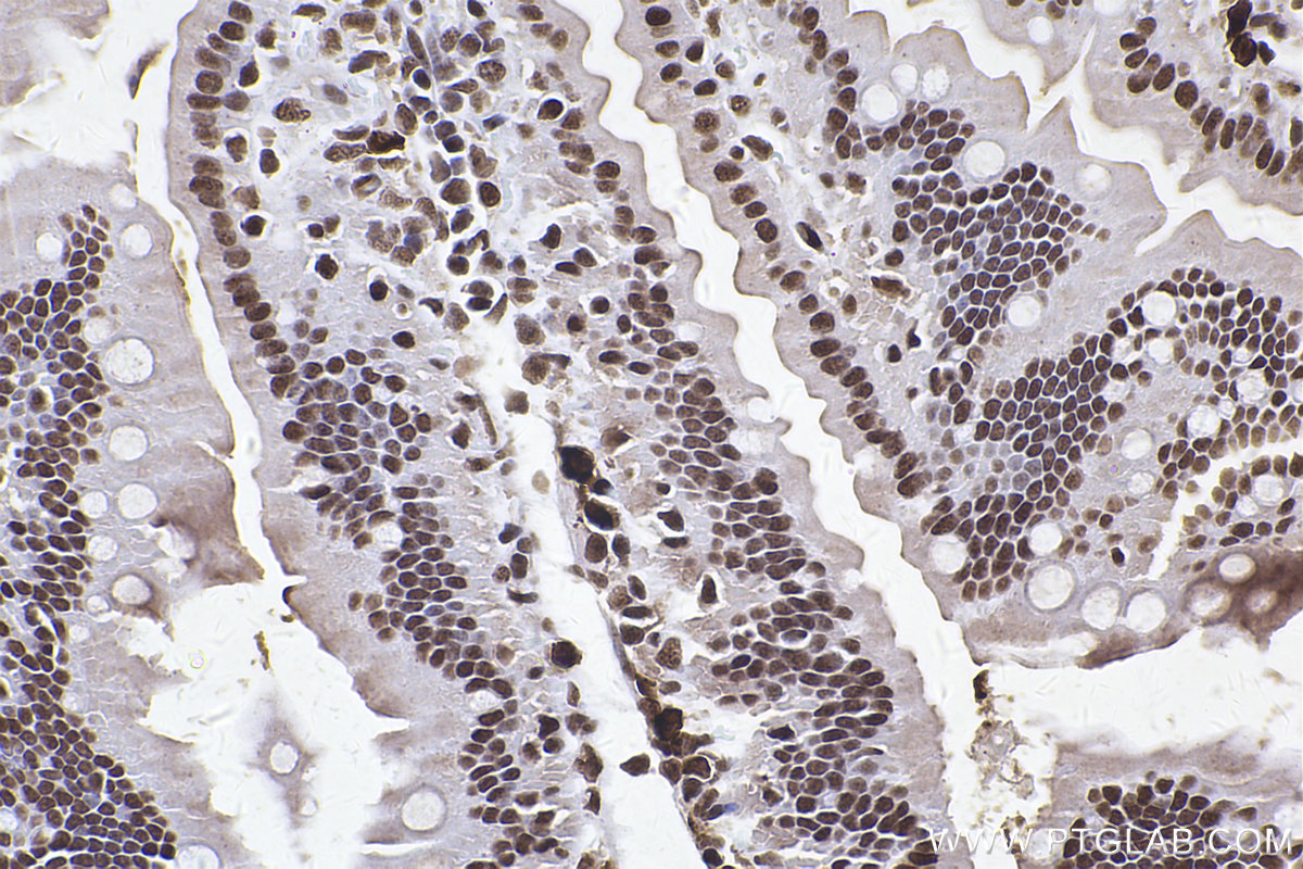 Immunohistochemical analysis of paraffin-embedded mouse small intestine tissue slide using KHC2465 (SMC1A IHC Kit).