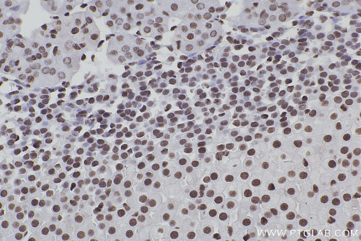 Immunohistochemical analysis of paraffin-embedded mouse adrenal gland tissue slide using KHC2465 (SMC1A IHC Kit).