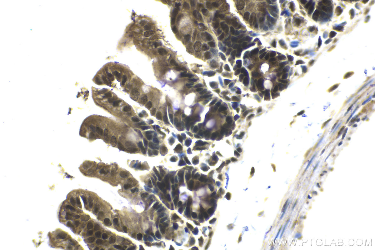 Immunohistochemical analysis of paraffin-embedded mouse small intestine tissue slide using KHC2143 (SMC2 IHC Kit).