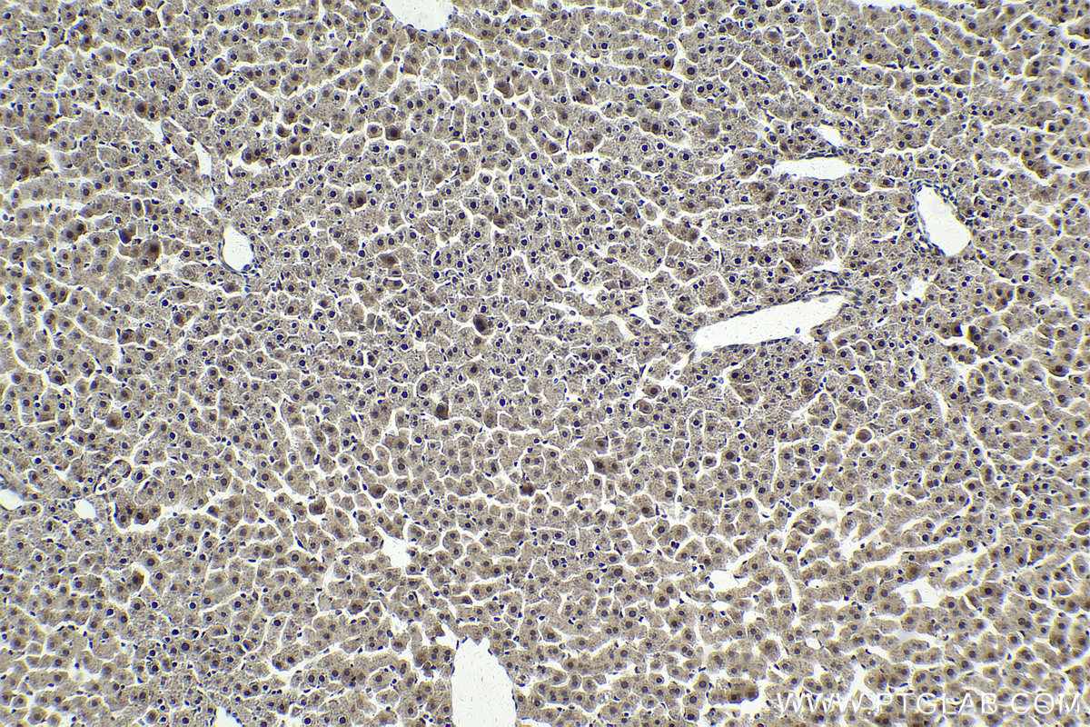 Immunohistochemical analysis of paraffin-embedded rat liver tissue slide using KHC2143 (SMC2 IHC Kit).