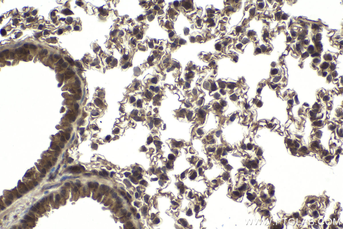 Immunohistochemical analysis of paraffin-embedded mouse lung tissue slide using KHC1941 (SMURF2 IHC Kit).