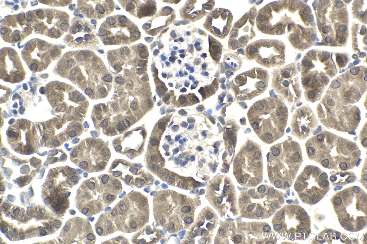 Immunohistochemical analysis of paraffin-embedded mouse kidney tissue slide using KHC1941 (SMURF2 IHC Kit).