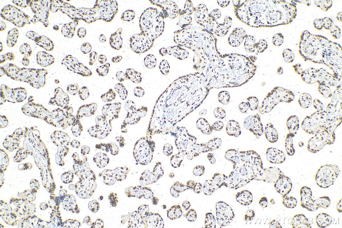Immunohistochemical analysis of paraffin-embedded human placenta tissue slide using KHC2118 (SNRNP200 IHC Kit).