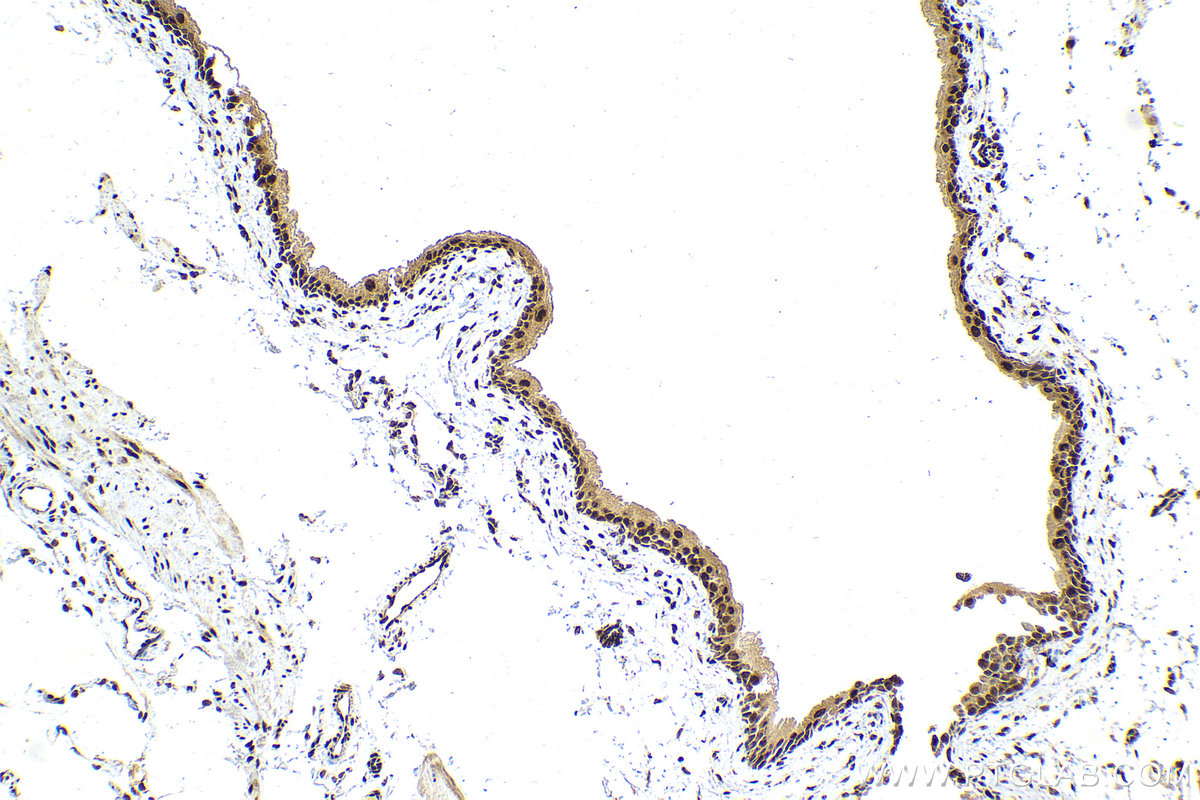 Immunohistochemical analysis of paraffin-embedded mouse bladder tissue slide using KHC2118 (SNRNP200 IHC Kit).