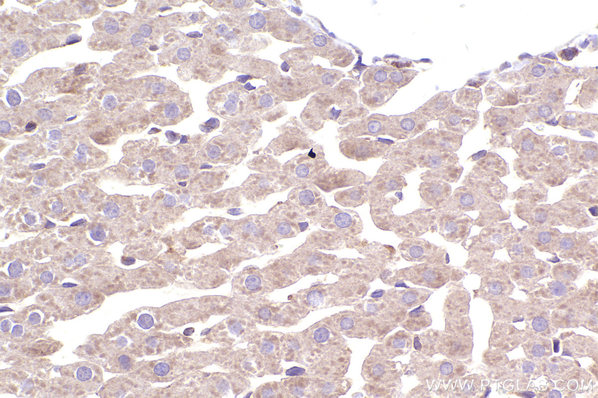 Immunohistochemical analysis of paraffin-embedded rat liver tissue slide using KHC2400 (SOS1 IHC Kit).