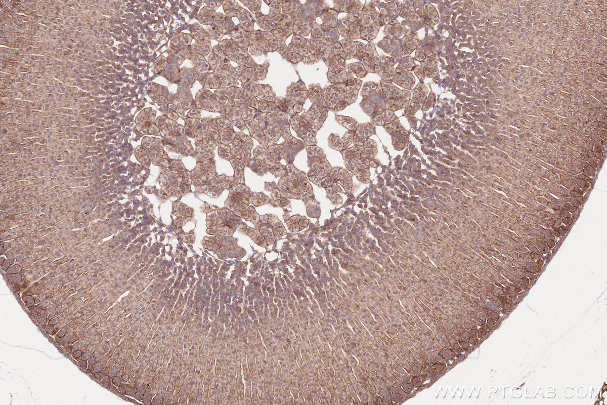 Immunohistochemical analysis of paraffin-embedded mouse adrenal gland tissue slide using KHC2574 (SPECC1L/CYTSA IHC Kit).