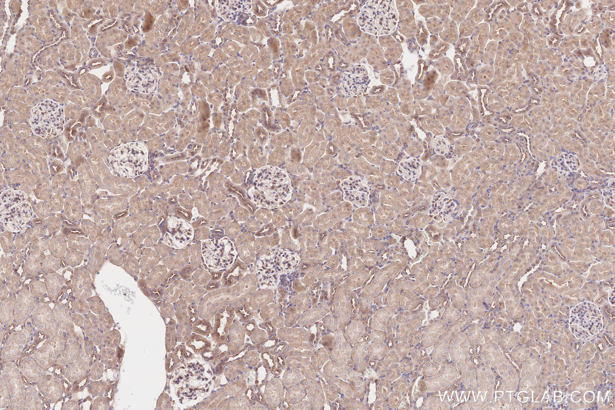 Immunohistochemical analysis of paraffin-embedded rat kidney tissue slide using KHC2574 (SPECC1L/CYTSA IHC Kit).