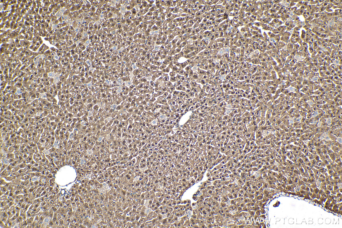 Immunohistochemical analysis of paraffin-embedded mouse liver tissue slide using KHC2105 (SRGAP2 IHC Kit).