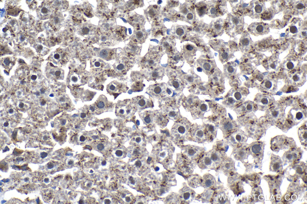 Immunohistochemical analysis of paraffin-embedded rat liver tissue slide using KHC2105 (SRGAP2 IHC Kit).