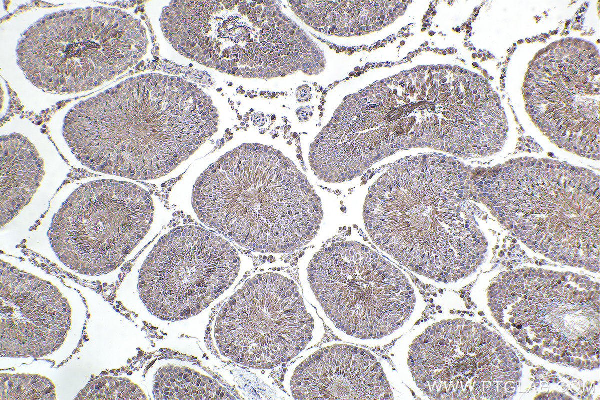 Immunohistochemical analysis of paraffin-embedded rat testis tissue slide using KHC2364 (SRPK2 IHC Kit).