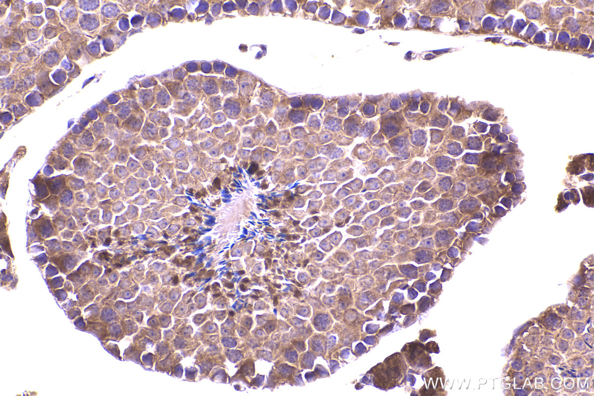 Immunohistochemical analysis of paraffin-embedded mouse testis tissue slide using KHC2364 (SRPK2 IHC Kit).