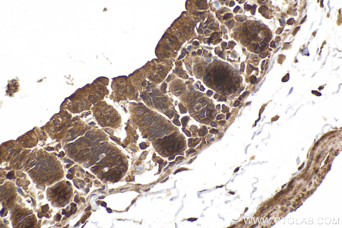Immunohistochemical analysis of paraffin-embedded mouse small intestine tissue slide using KHC2139 (STAM2 IHC Kit).