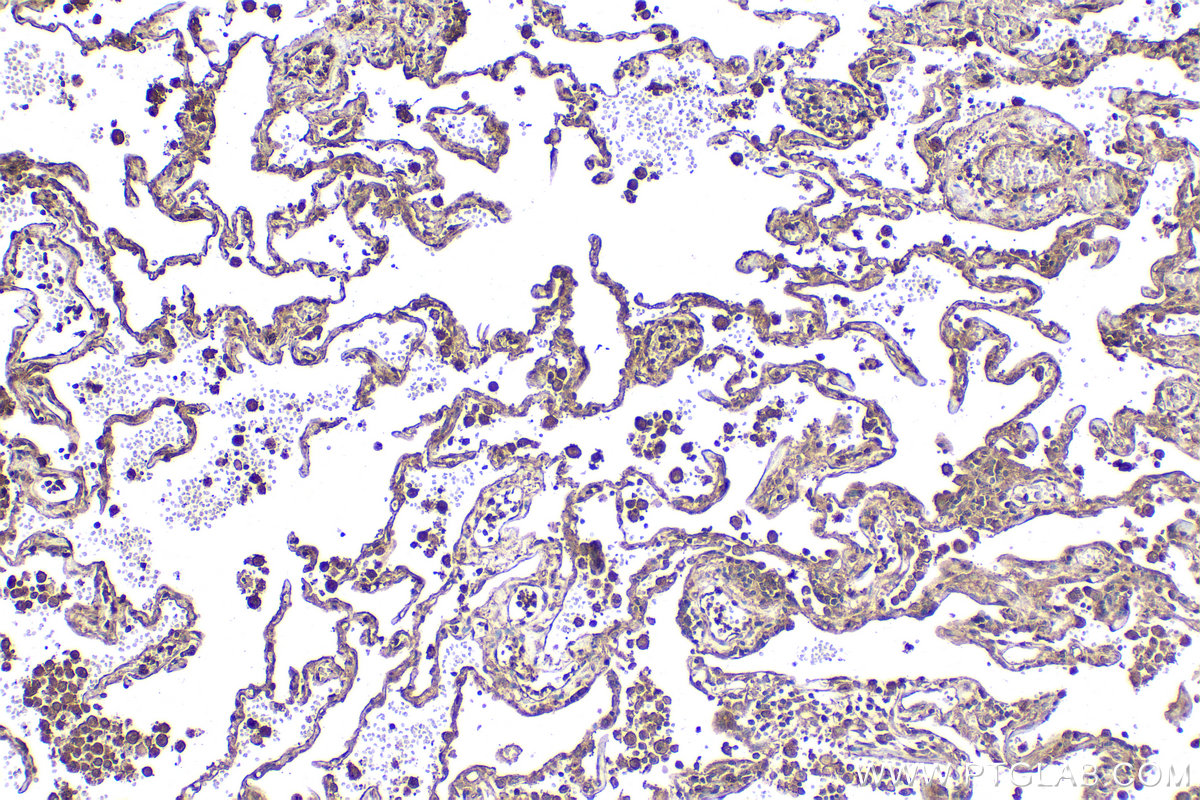 Immunohistochemical analysis of paraffin-embedded human lung tissue slide using KHC2139 (STAM2 IHC Kit).