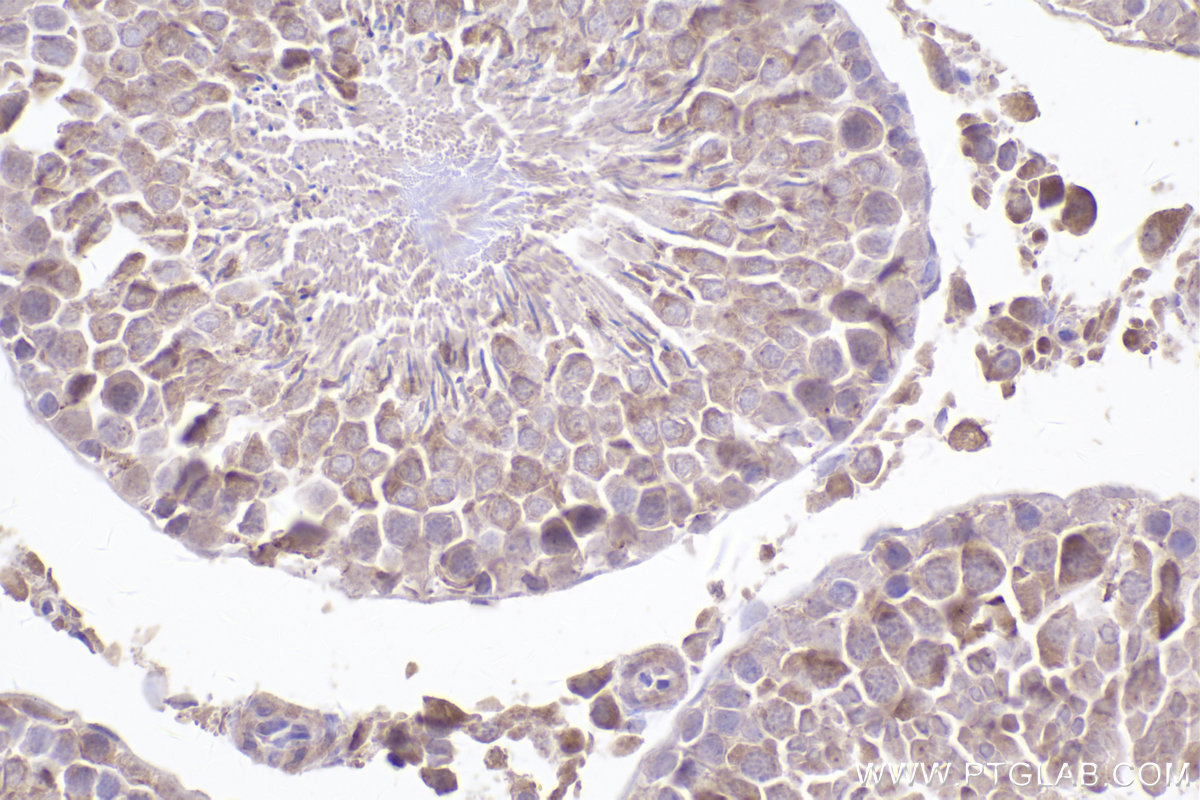 Immunohistochemical analysis of paraffin-embedded rat testis tissue slide using KHC2489 (STIL IHC Kit).