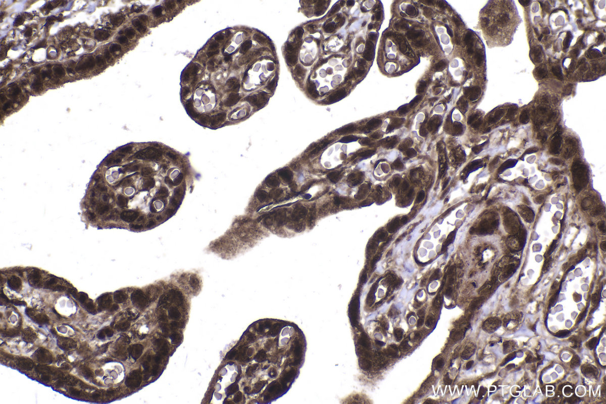 Immunohistochemical analysis of paraffin-embedded human placenta tissue slide using KHC2237 (STIP1 IHC Kit).