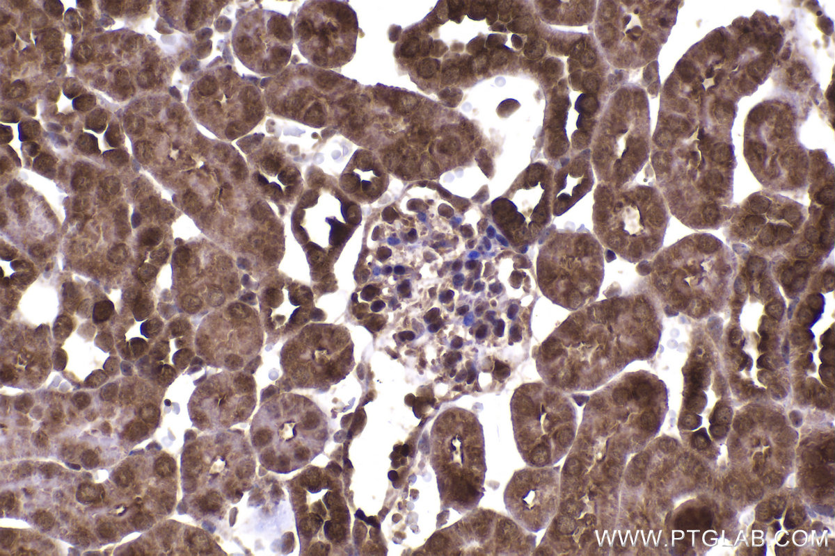 Immunohistochemical analysis of paraffin-embedded mouse kidney tissue slide using KHC2237 (STIP1 IHC Kit).