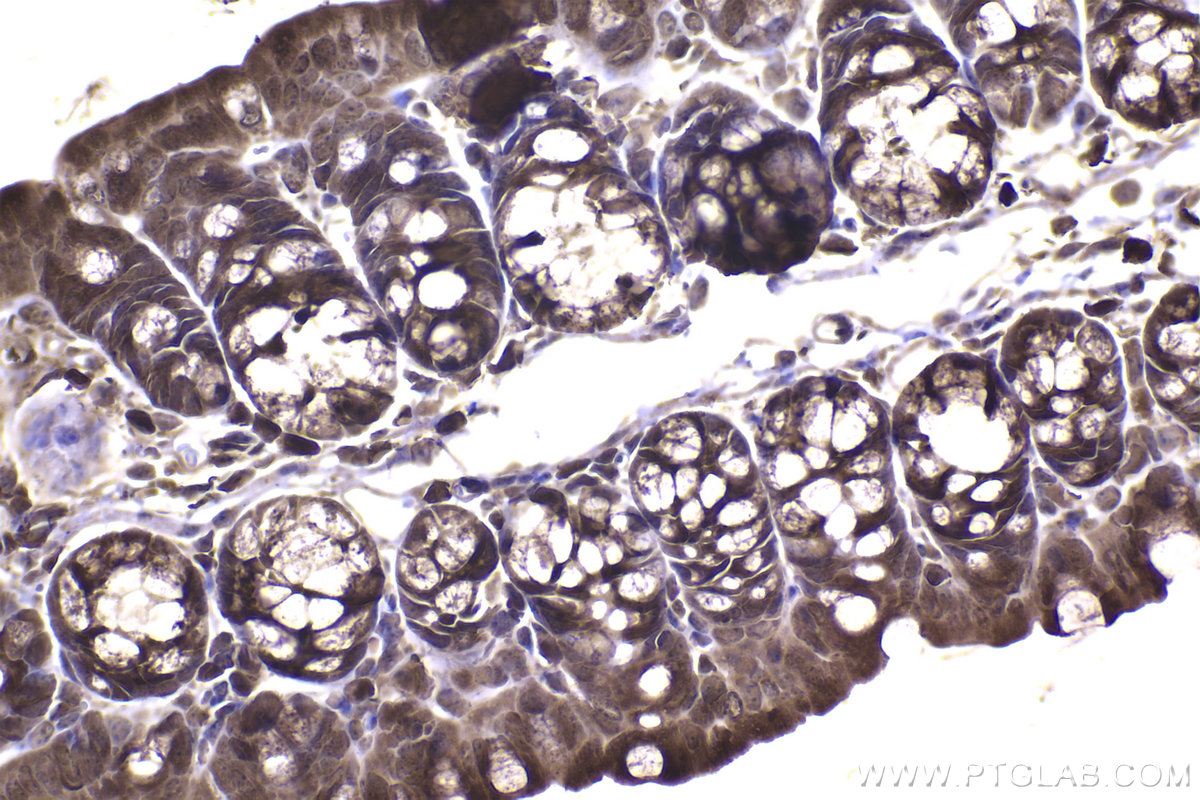 Immunohistochemical analysis of paraffin-embedded mouse small intestine tissue slide using KHC2237 (STIP1 IHC Kit).