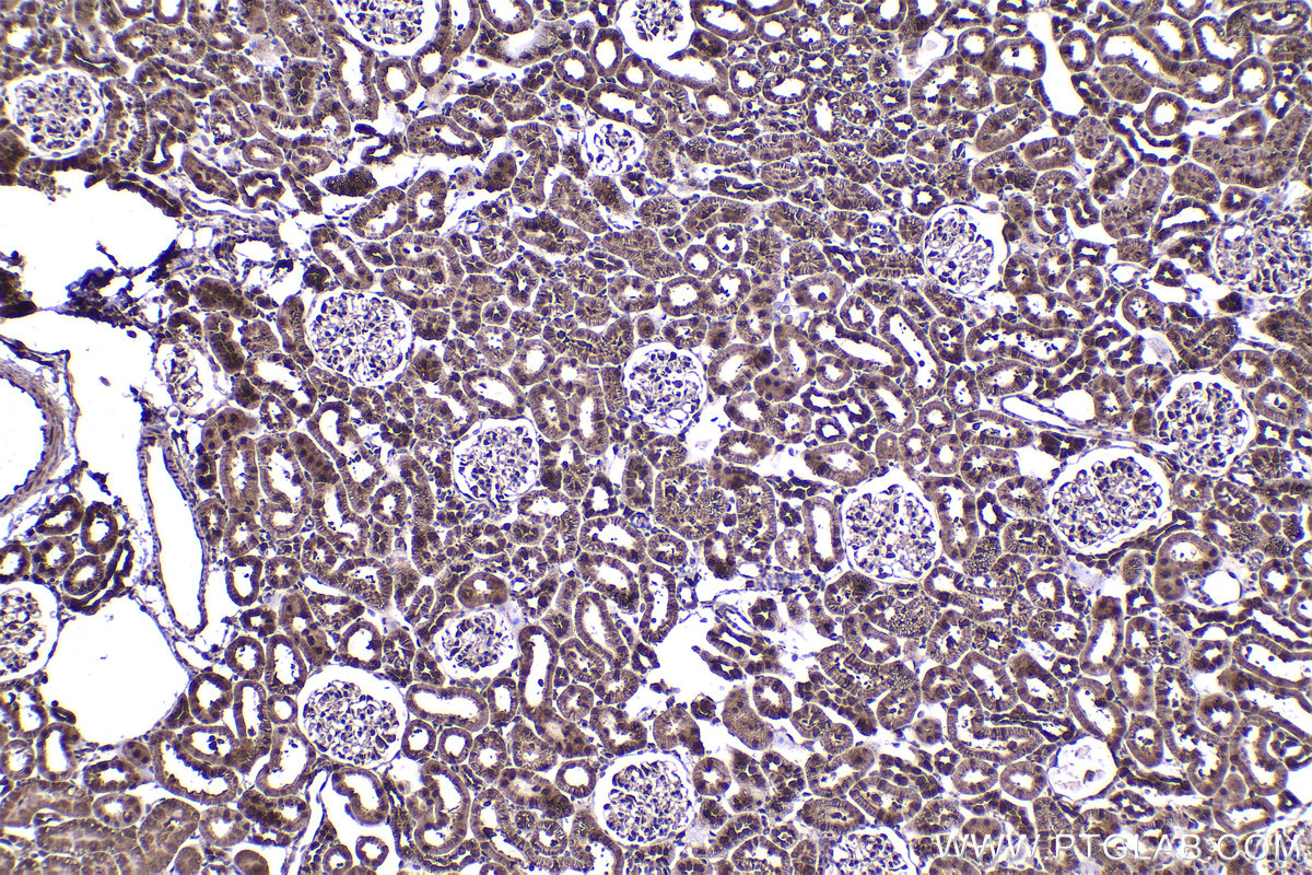 Immunohistochemical analysis of paraffin-embedded rat kidney tissue slide using KHC2237 (STIP1 IHC Kit).