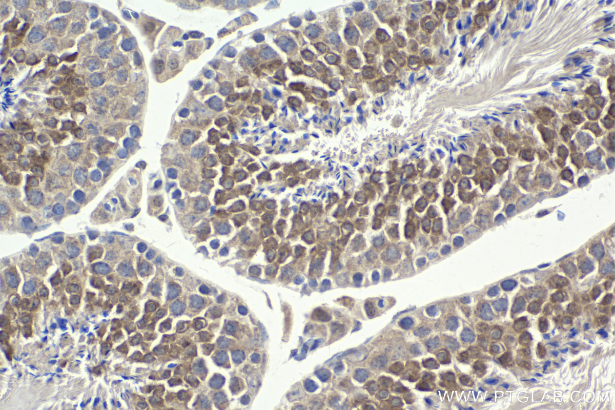 Immunohistochemical analysis of paraffin-embedded mouse testis tissue slide using KHC1962 (STK36 IHC Kit).