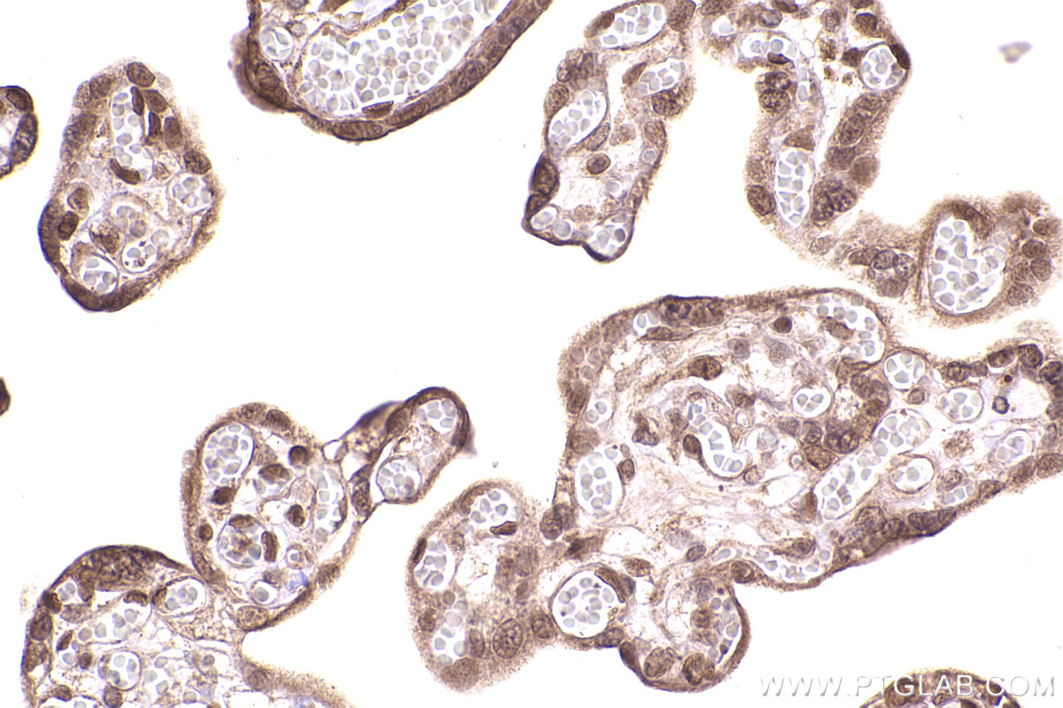 Immunohistochemical analysis of paraffin-embedded human placenta tissue slide using KHC2483 (STK38 IHC Kit).