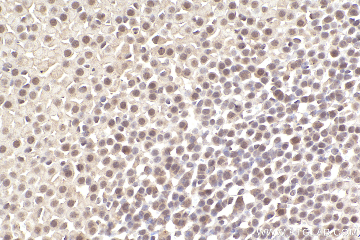 Immunohistochemical analysis of paraffin-embedded mouse adrenal gland tissue slide using KHC2483 (STK38 IHC Kit).