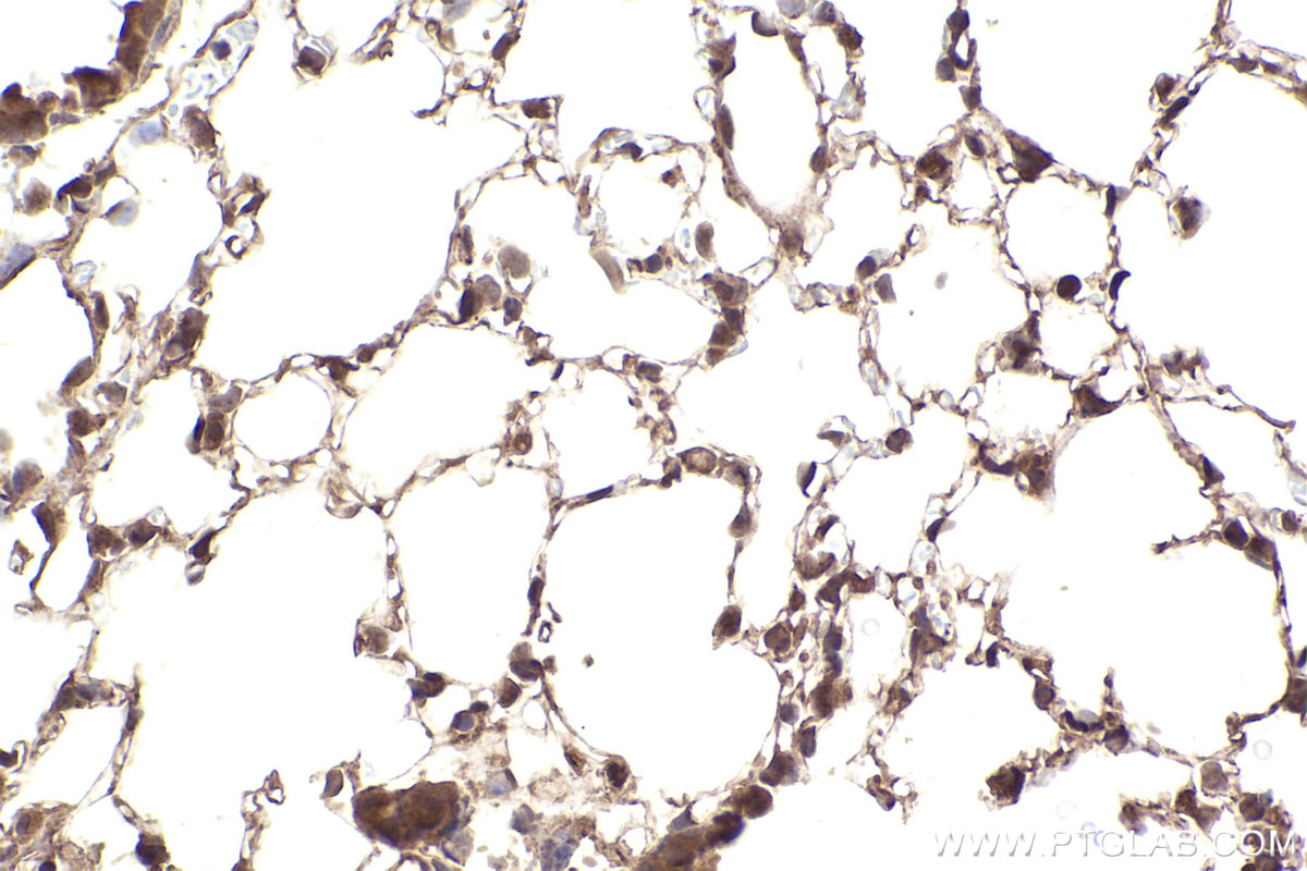 Immunohistochemical analysis of paraffin-embedded mouse lung tissue slide using KHC2483 (STK38 IHC Kit).