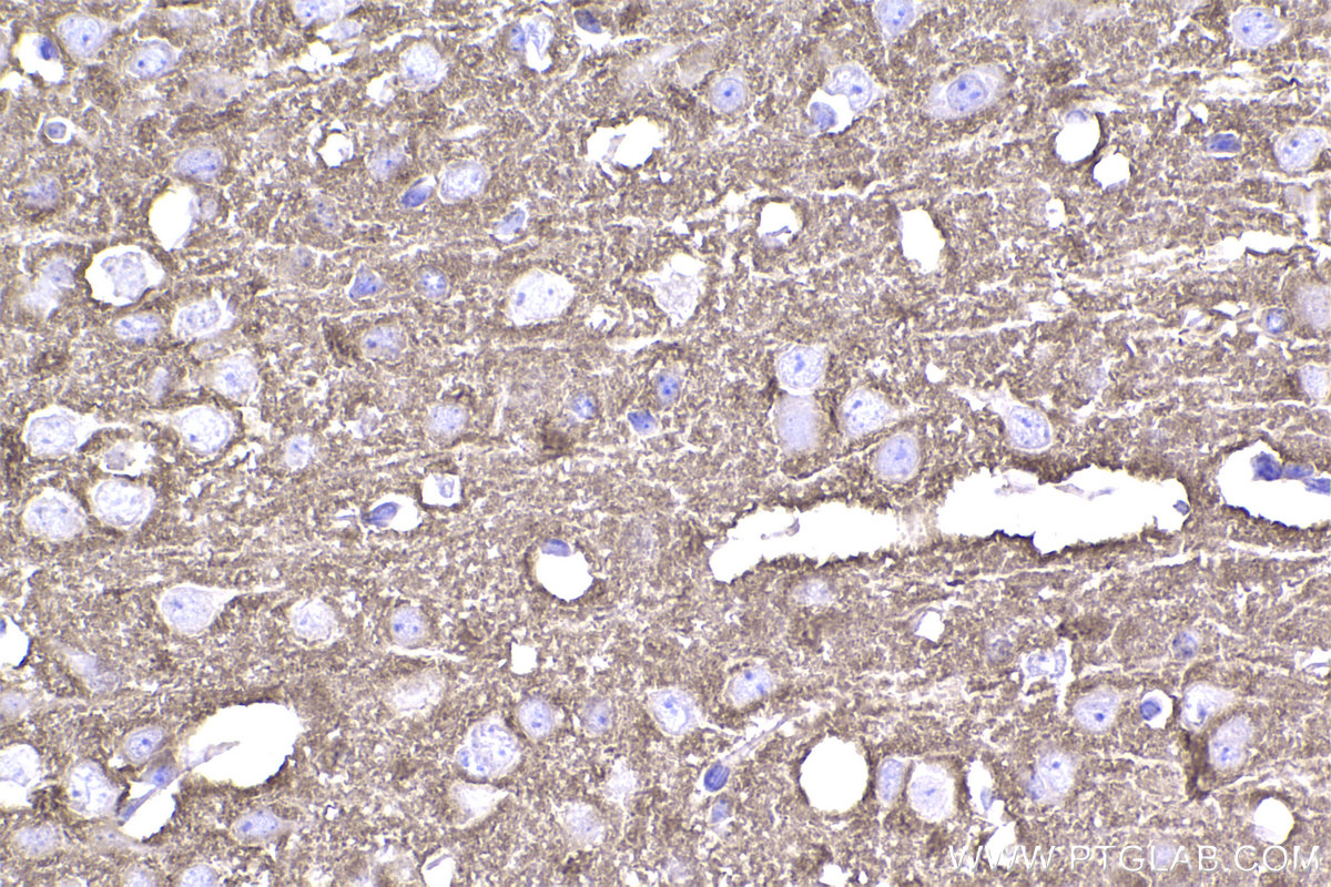 Immunohistochemical analysis of paraffin-embedded mouse brain tissue slide using KHC2341 (STXBP1 IHC Kit).