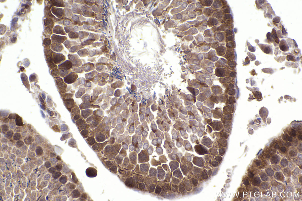 Immunohistochemical analysis of paraffin-embedded rat testis tissue slide using KHC2341 (STXBP1 IHC Kit).