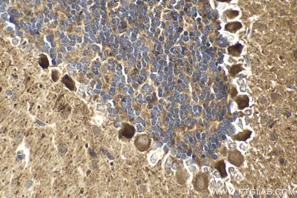 Immunohistochemical analysis of paraffin-embedded mouse cerebellum tissue slide using KHC2001 (SUFU IHC Kit).